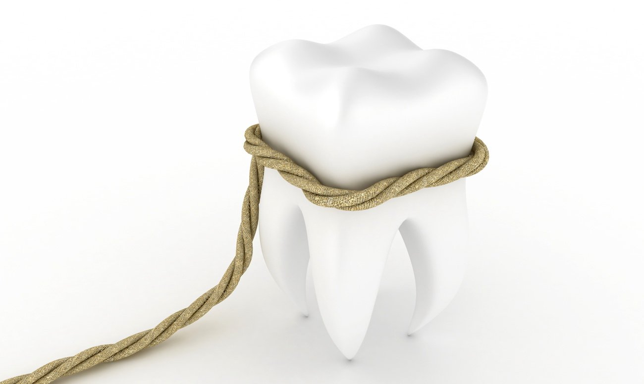 Удаление зубов в новом Уренгое